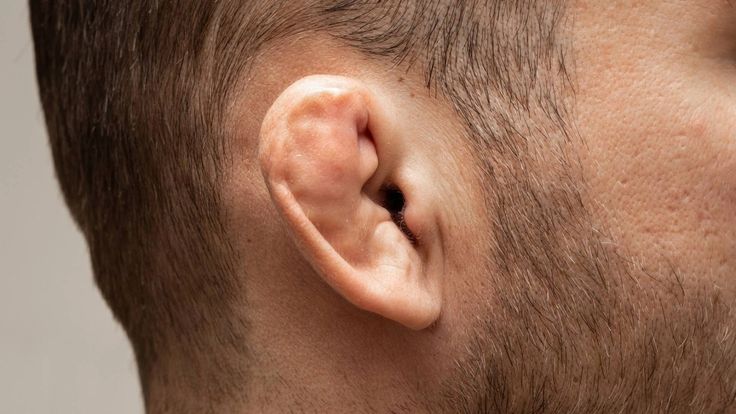 Cauliflower Ear: What It Is, Causes & Treatment